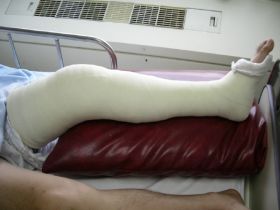 Noua moda in randul traficantilor de droguri... ghipsul din cocaina