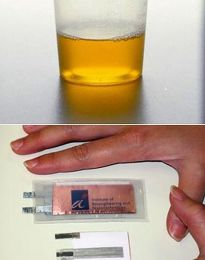 S-a descoperit bateria care functioneaza cu urina