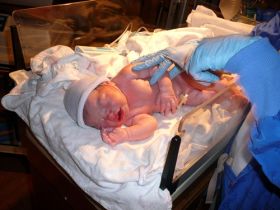 Socant: O botoseneanca a adus pe lume un bebelus fara abdomen, cu intestinele la vedere