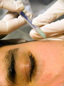 Descoperire revolutionara! Botox-ul ajuta la refacerea podoabei capilare