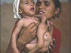 Copil cu opt membre, venerat ca zeu in Nepal