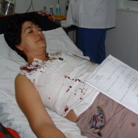 O avocata din Timisoara, snopita in bataie de sase tigani