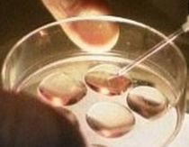 Ministerul Sanatatii va aloca 500.000 euro pentru sustinerea cuplurilor care recurg la fertilizarea in vitro