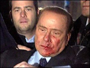 Silvio Berlusconi, plin de sange, dupa ce a fost lovit cu pumnul