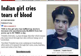 O adolescenta din India plange cu lacrimi de sange