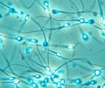 Test de fertilitate pentru barbati