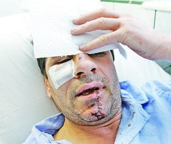 Ogica si-a pierdut norocul: batut mar in Clubul Le Gaga