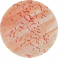 Franta: 6 copii la spital infectati cu bacteria E.coli