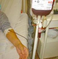 Dezvoltarea hepatitei C, 