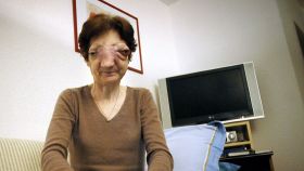 Chantal Sebire, desfigurata de o tumoare cumplita, asteapta acceptul lui Sarkozy de a fi eutanasiata