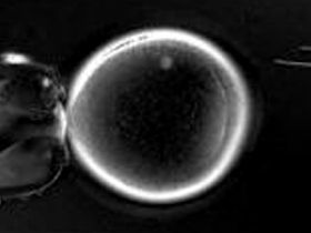 Celulele susa clonate ar putea trata maladia Parkinson