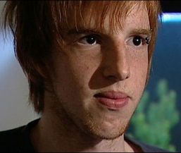 Terapia genetica i-a redat vederea unui adolescent