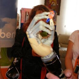Mana bionica i-LIMB, disponibila si in Romania