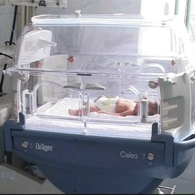 O copila de 16 ani din Brasov a nascut siamezi care impart aceeasi cutie craniana