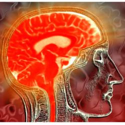 Consumul de alcool duce la micsorarea creierului