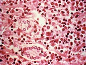 O enzima din corpul uman, element cheie pentru producerea 