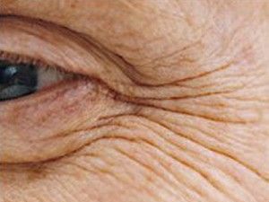 Dietele si produsele cosmetice, ineficiente in combaterea imbatranirii