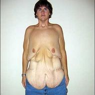 Si-a pierdut virginitatea dupa ce a slabit 184 de kilograme