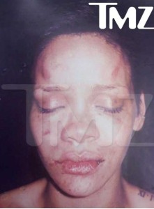 Primele poze cu Rihanna desfigurata de rapperul Chris Brown