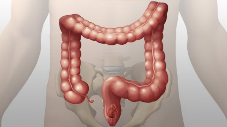 Cum a început incendiul de la Notre Dame și de ce a fost stins greu - REALITATE AUGMENTATĂ