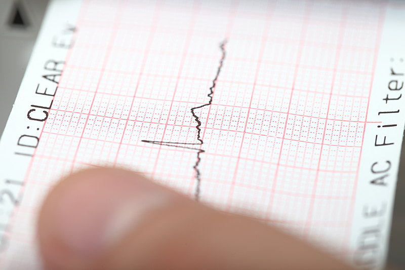 Un nou cutremur major în peninsula rusă Kamceatka, la mai puțin de două săptămâni de la cel de 8,8