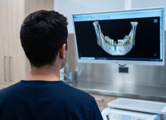 Implant dentar: cât durează, când se poate pune dintele imediat și ce se întâmplă cu osul dacă amâni